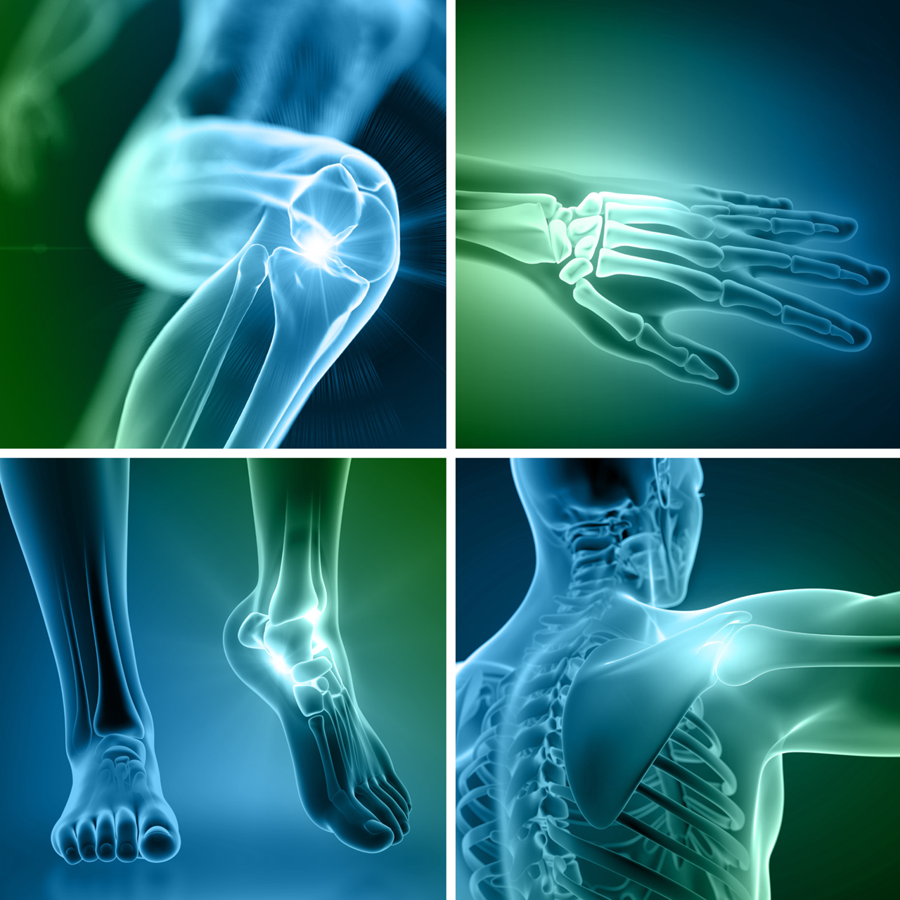 rthopedics and sports medicine solutions by Spectrum Plastics Group