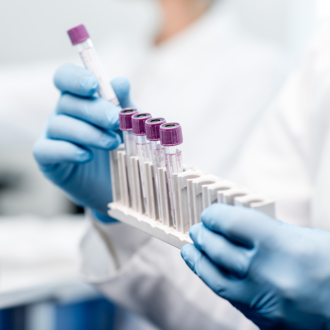 Extruded tubing, representing Spectrum Plastics Group's diagnostics solutions